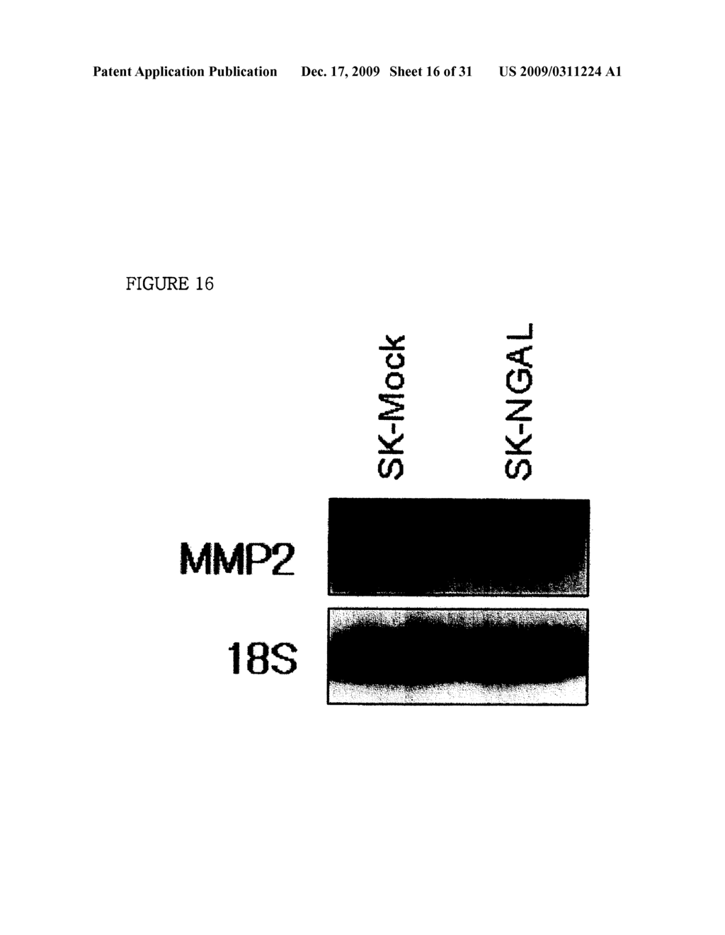 THERAPEUTIC AGENT COMPRISING LIPOCALIN 2 AGAINST CANCER METASTASIS, AND METHODS OF EARLY DIAGNOSIS AND INHIBITION OF CANCER METASTASIS USING LIPOCALIN 2 - diagram, schematic, and image 17