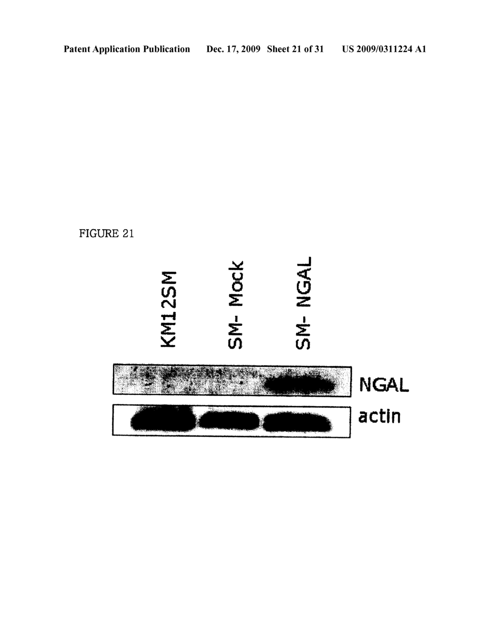 THERAPEUTIC AGENT COMPRISING LIPOCALIN 2 AGAINST CANCER METASTASIS, AND METHODS OF EARLY DIAGNOSIS AND INHIBITION OF CANCER METASTASIS USING LIPOCALIN 2 - diagram, schematic, and image 22