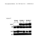 THERAPEUTIC AGENT COMPRISING LIPOCALIN 2 AGAINST CANCER METASTASIS, AND METHODS OF EARLY DIAGNOSIS AND INHIBITION OF CANCER METASTASIS USING LIPOCALIN 2 diagram and image