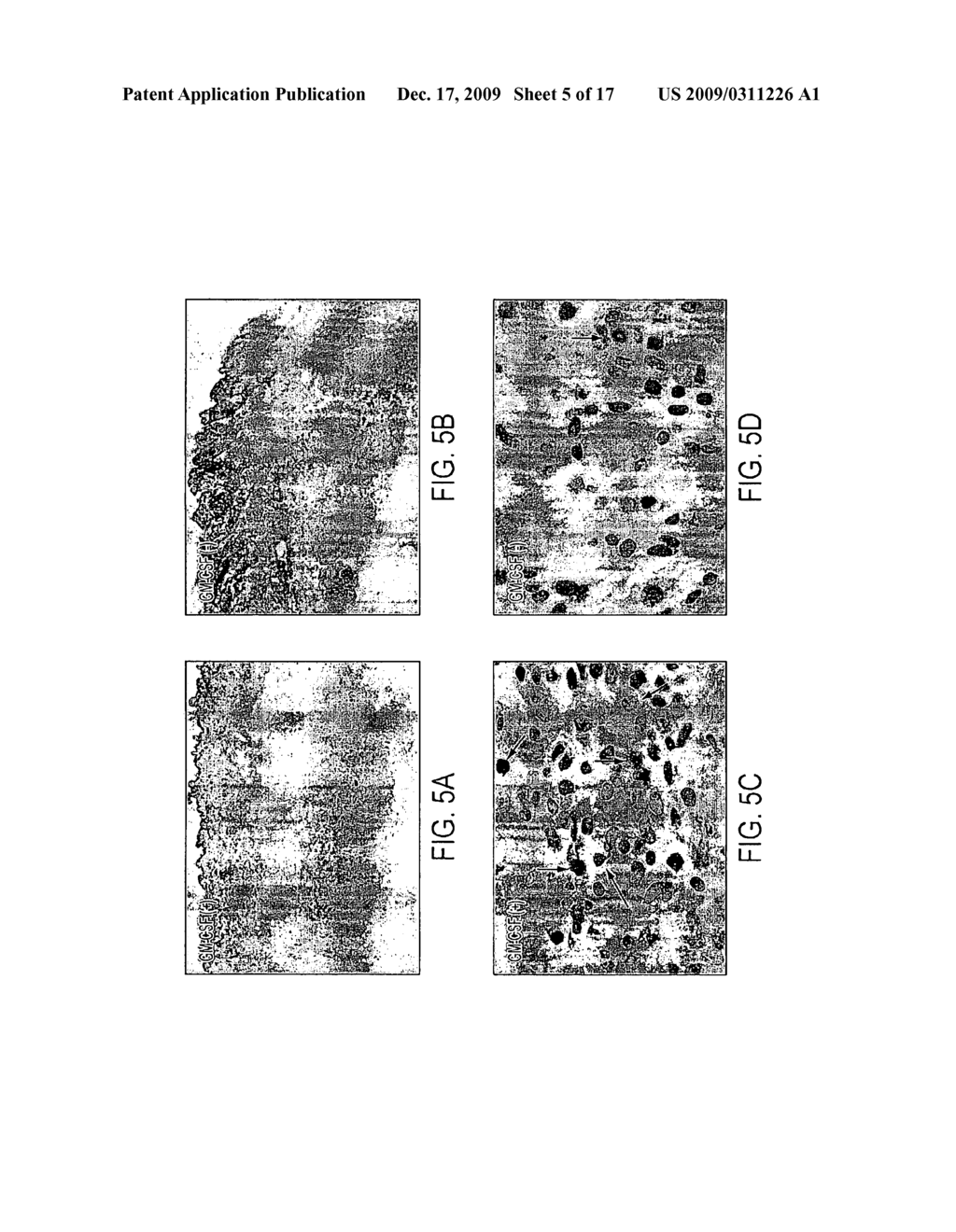 COMPOSITION AND METHOD FOR TREATING ESOPHAGEAL DYSPLASIA - diagram, schematic, and image 06