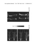 Anti-activin antibodies and uses for promoting bone growth diagram and image