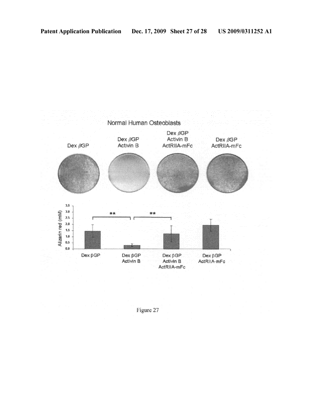 Anti-activin antibodies and uses for promoting bone growth - diagram, schematic, and image 28