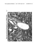 METHODS FOR TREATING TWEAK-RELATED CONDITIONS diagram and image