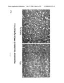 METHODS FOR TREATING TWEAK-RELATED CONDITIONS diagram and image