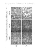 METHODS FOR TREATING TWEAK-RELATED CONDITIONS diagram and image