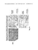 METHODS FOR TREATING TWEAK-RELATED CONDITIONS diagram and image