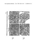 METHODS FOR TREATING TWEAK-RELATED CONDITIONS diagram and image