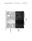 METHODS FOR TREATING TWEAK-RELATED CONDITIONS diagram and image