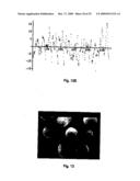 Oral Preparation With Controlled Release diagram and image