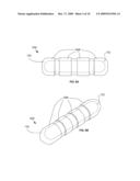 DEVICES TO RESIST MIGRATION AND ROTATION OF IMPLANTS USED IN BRACHYTHERAPY AND OTHER RADIATION THERAPY diagram and image