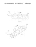 DEVICES TO RESIST MIGRATION AND ROTATION OF IMPLANTS USED IN BRACHYTHERAPY AND OTHER RADIATION THERAPY diagram and image