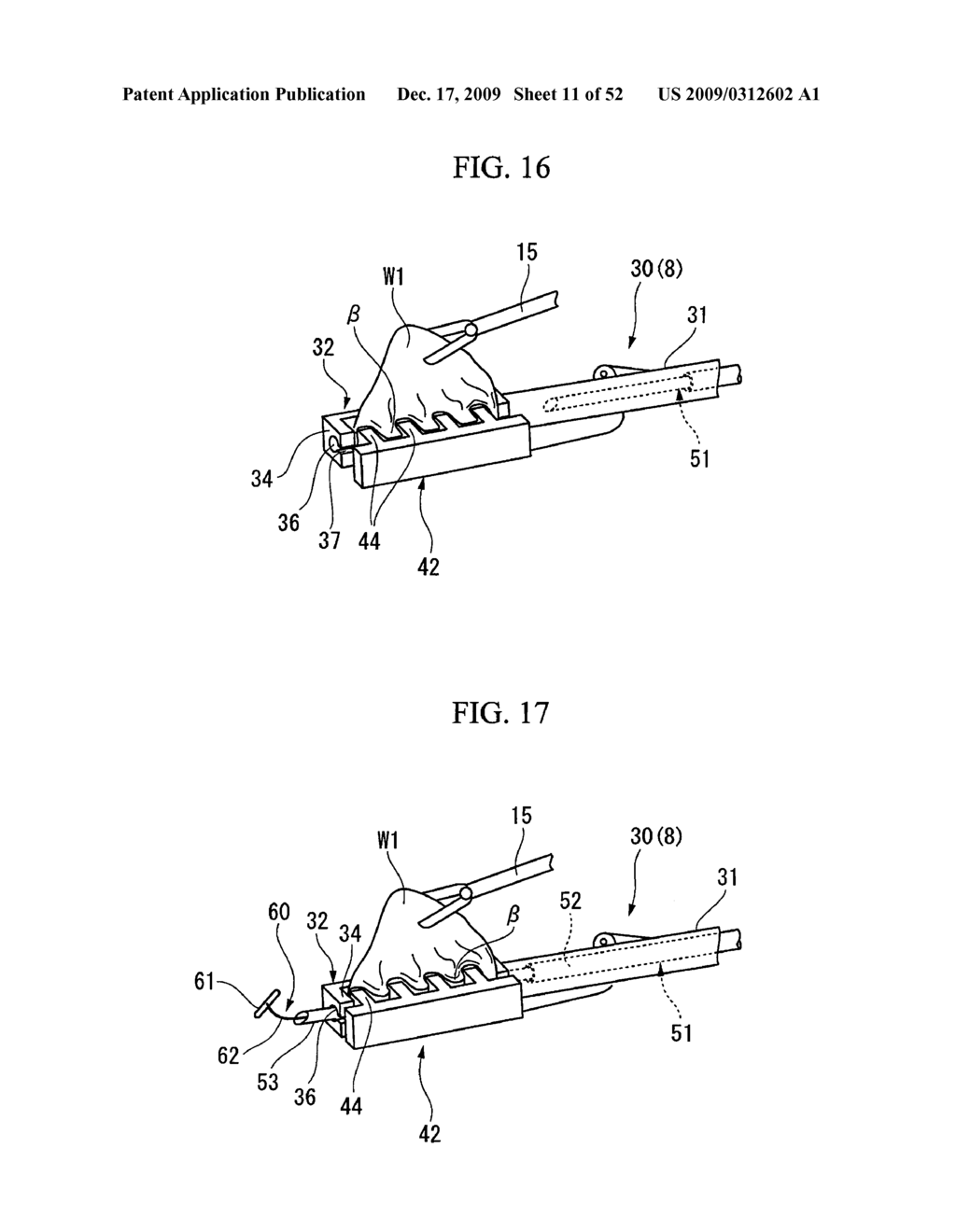 PRESSING MEMBER, ENDOSCOPIC TREATMENT SYSTEM, AND ENDOSCOPIC SUTURING DEVICE - diagram, schematic, and image 12