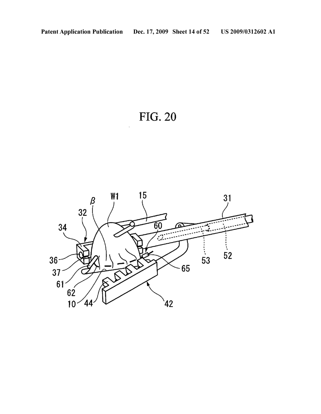 PRESSING MEMBER, ENDOSCOPIC TREATMENT SYSTEM, AND ENDOSCOPIC SUTURING DEVICE - diagram, schematic, and image 15