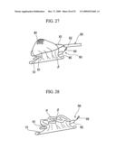 PRESSING MEMBER, ENDOSCOPIC TREATMENT SYSTEM, AND ENDOSCOPIC SUTURING DEVICE diagram and image