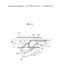 PRESSING MEMBER, ENDOSCOPIC TREATMENT SYSTEM, AND ENDOSCOPIC SUTURING DEVICE diagram and image