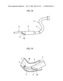 PRESSING MEMBER, ENDOSCOPIC TREATMENT SYSTEM, AND ENDOSCOPIC SUTURING DEVICE diagram and image