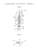 PRESSING MEMBER, ENDOSCOPIC TREATMENT SYSTEM, AND ENDOSCOPIC SUTURING DEVICE diagram and image