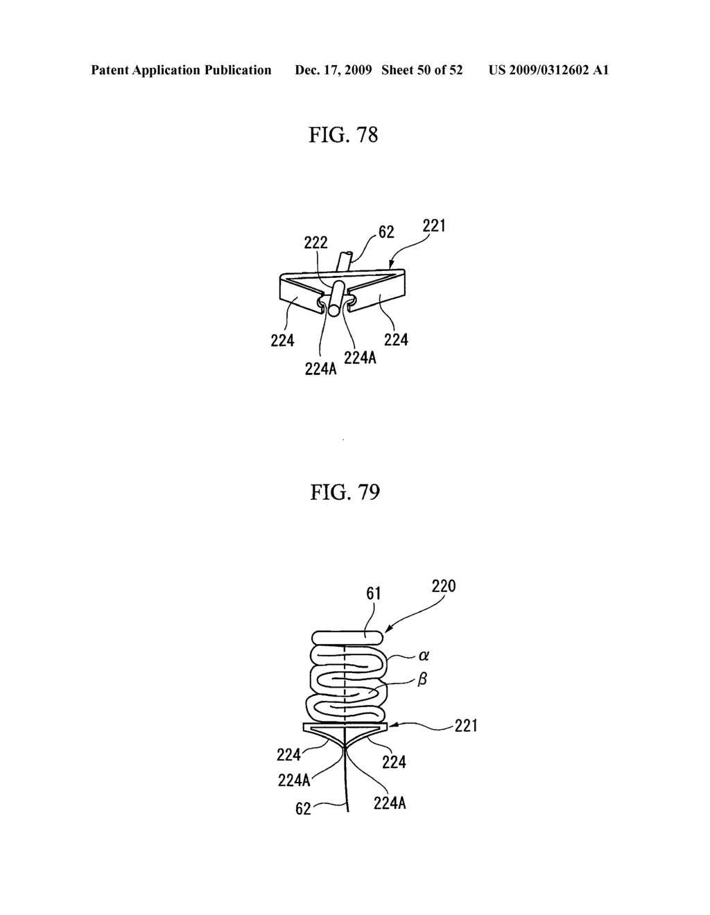 PRESSING MEMBER, ENDOSCOPIC TREATMENT SYSTEM, AND ENDOSCOPIC SUTURING DEVICE - diagram, schematic, and image 51