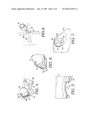 ERGONOMIC HANDLE AND ARTICULATING LAPAROSCOPIC TOOL diagram and image