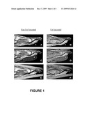 ARTICLES AND METHODS FOR IMPROVING MRI IMAGING diagram and image