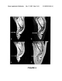 ARTICLES AND METHODS FOR IMPROVING MRI IMAGING diagram and image