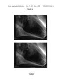 Adaptive Medical Image Acquisition System diagram and image