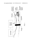 SUB-ATMOSPHERIC PRESSURE CHAMBER FOR MECHANICAL ASSISTANCE OF BLOOD FLOW diagram and image