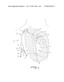 Dialysis Catheter diagram and image