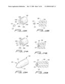 Dialysis Catheter diagram and image