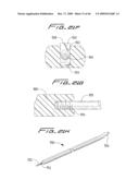 Dialysis Catheter diagram and image