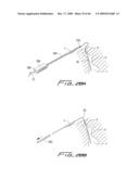 Dialysis Catheter diagram and image