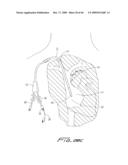 Dialysis Catheter diagram and image