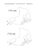 Dialysis Catheter diagram and image