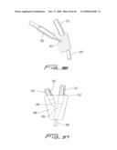 Dialysis Catheter diagram and image