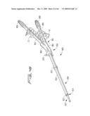 Dialysis Catheter diagram and image