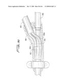 Dialysis Catheter diagram and image