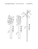 BI-DIRECTIONAL STEERABLE SHEATH diagram and image