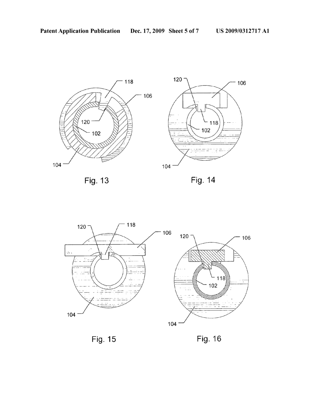 Medical Delivery System with a Rotatable Coding Element - diagram, schematic, and image 06