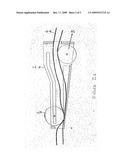 Intravenous drip set controller with flusher diagram and image