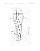 Intravenous drip set controller with flusher diagram and image