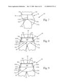 Absorbent Article Comprising A Design Field diagram and image