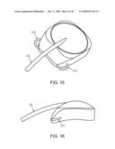 DRUG-DELIVERY PUMPS AND METHODS OF MANUFACTURE diagram and image