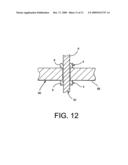 External fixator diagram and image