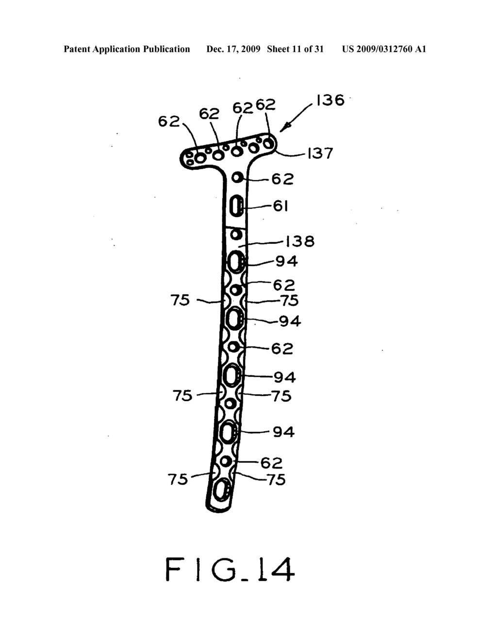 BONE FRACTURE FIXATION SYSTEM - diagram, schematic, and image 12