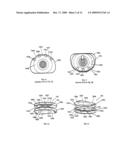 Wedge Ramp Distractor for use in Implanting Artificial Intervertebral Discs diagram and image