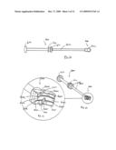 Wedge Ramp Distractor for use in Implanting Artificial Intervertebral Discs diagram and image