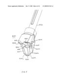 Wedge Ramp Distractor for use in Implanting Artificial Intervertebral Discs diagram and image