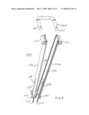 Wedge Ramp Distractor for use in Implanting Artificial Intervertebral Discs diagram and image