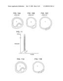 SHOCKWAVE BALLOON CATHETER SYSTEM diagram and image