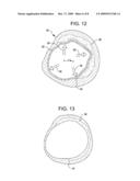 SHOCKWAVE BALLOON CATHETER SYSTEM diagram and image